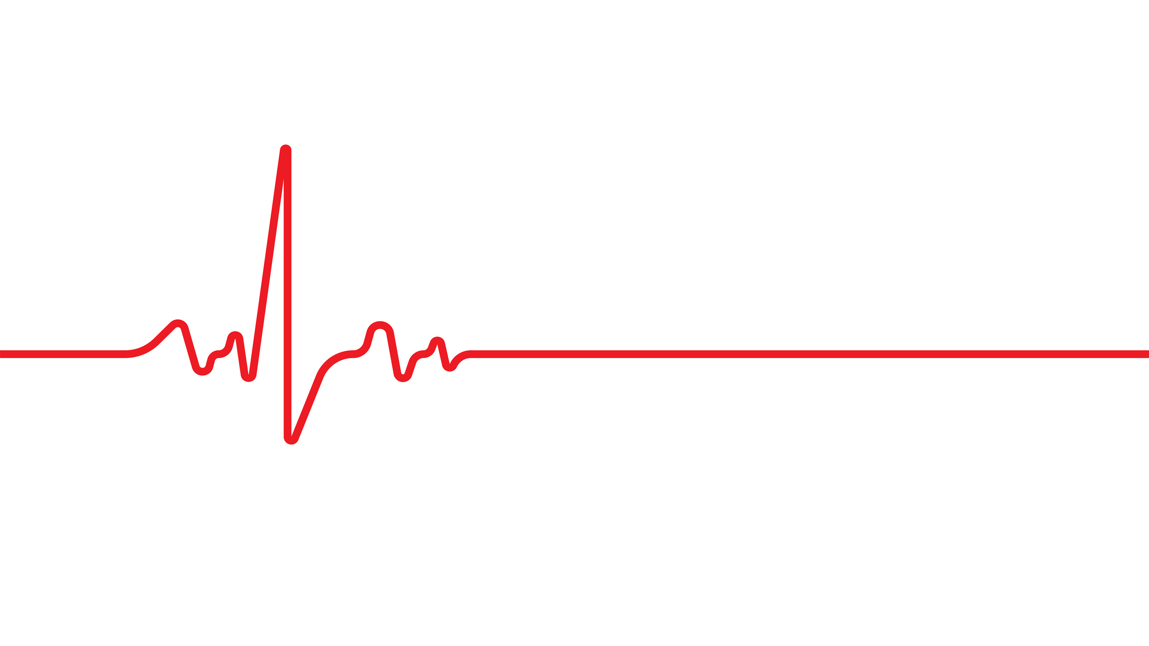 Emergency ekg monitoring. Heart beat. Electrocardiogram